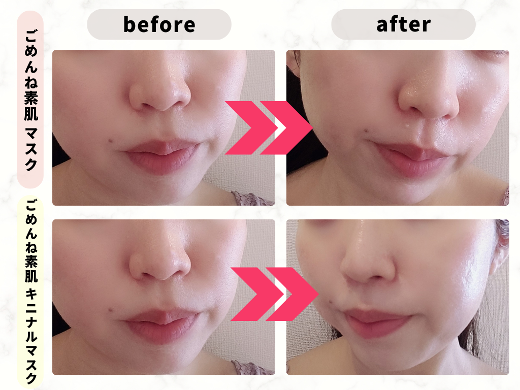 素肌 人気の「ごめんね素肌パック」はどっちがいい？キニナルとの違いを比較！使い方・口コミも | ハピコス powered by マイナビおすすめナビ